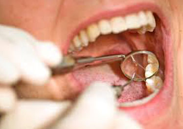 Painless Root Canals